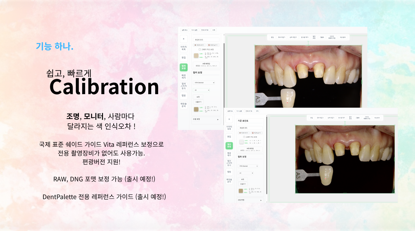 DentPalette - AI 쉐이드 매핑 솔루션