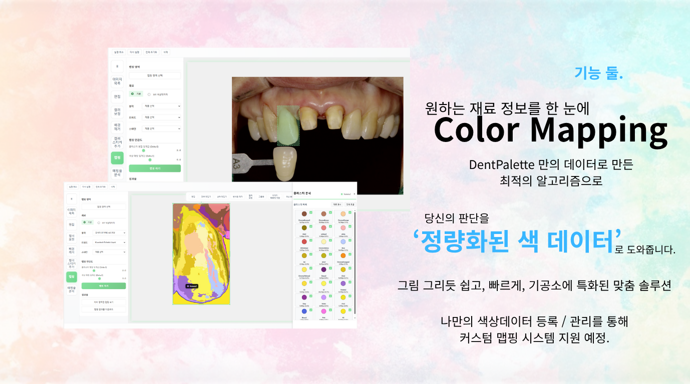 DentPalette - AI 쉐이드 매핑 솔루션