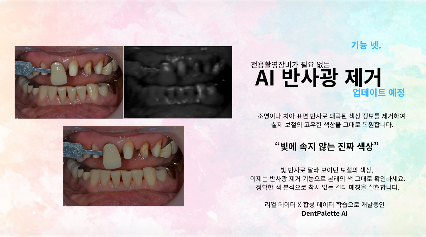 DentPalette - AI 쉐이드 매핑 솔루션